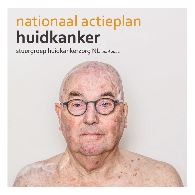 nationaal actieplan huidkanker 2021
