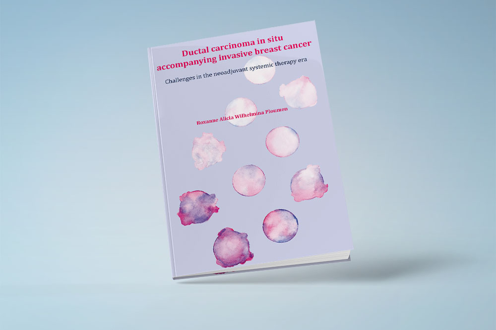 Proefschrift Roxanne Ploumen behandeling invasieve borstkanker DCIS component